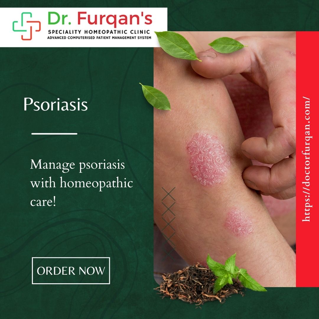 Psoriasis